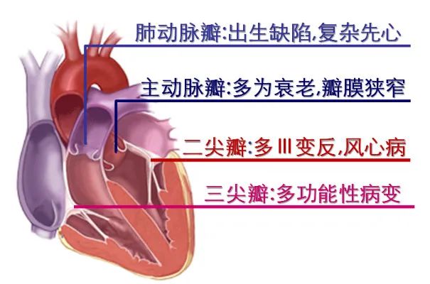 心脏瓣膜置换最新技术，重塑生命的精密手术